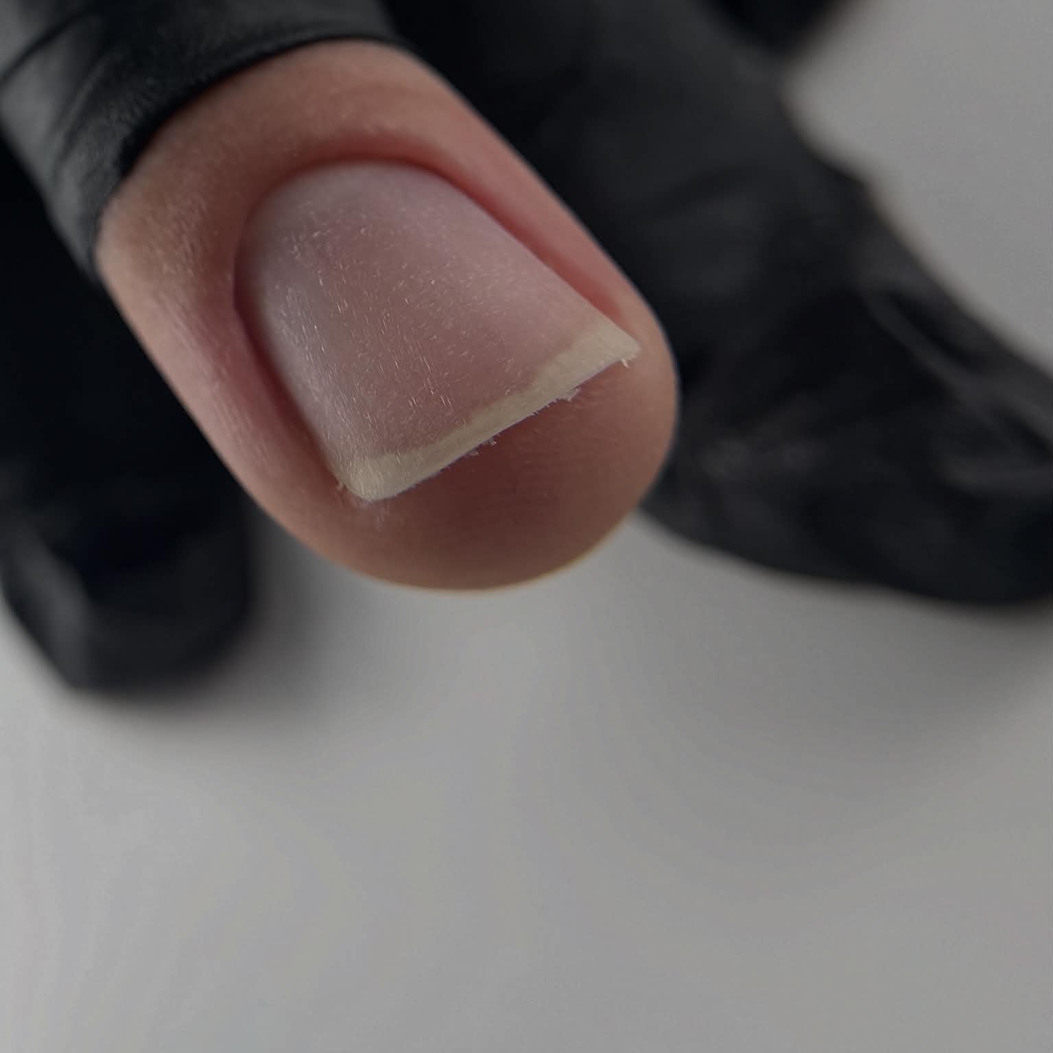 Préparation de l’ongle vue de profil